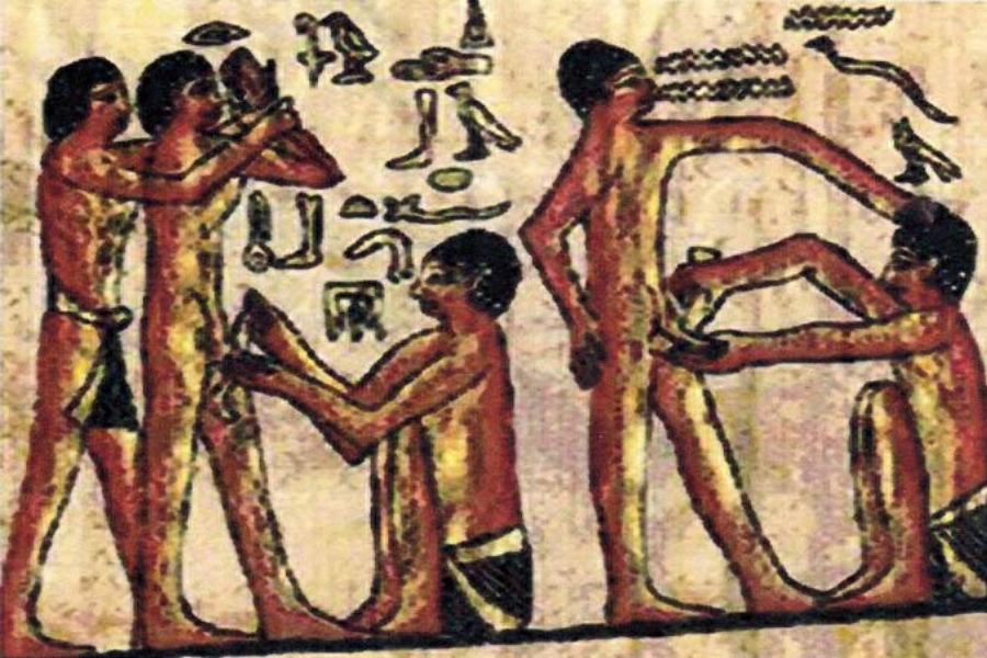 Kondomy ve starověkém Egyptě